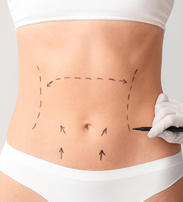 Getting to Your Ideal Body Shape with Laser-Assisted Liposuction